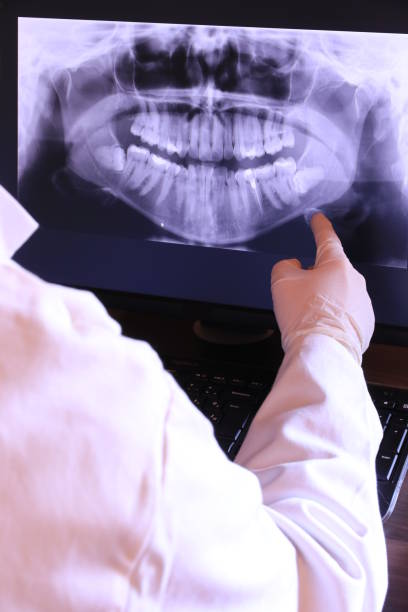 Best Emergency Tooth Extraction in Cao, ND